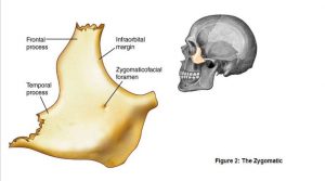 Medical illustration of the Zygomatic Arch