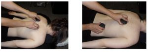 a photo showing the therapist alternating hands with the hot stones